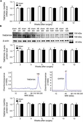 TMEM16A Plays an Insignificant Role in Myocardium Remodeling but May Promote Angiogenesis of Heart During Pressure-overload